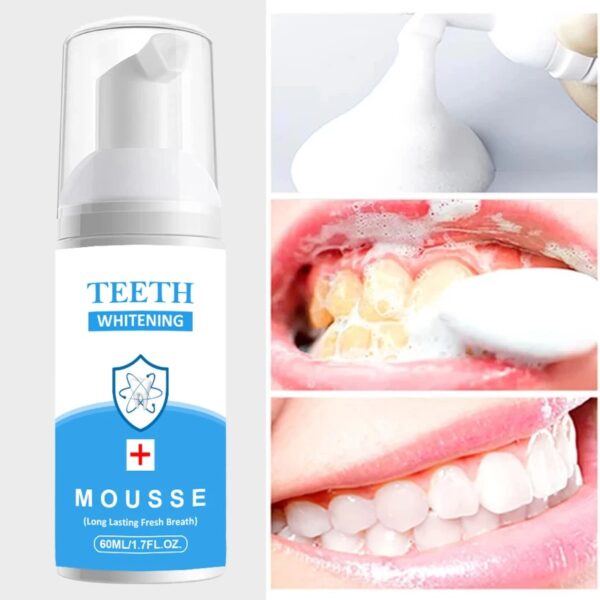 Vishvambhari Teeth Whitening Mousse Foam For Gums 60Ml