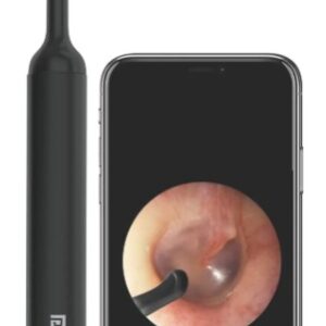 Portronics XLIFE Smart Wireless Ear Otoscope