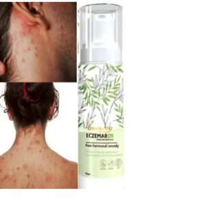 Eczemaron Cream Skin Guard Funga Skin Care SPRAY 50 ml