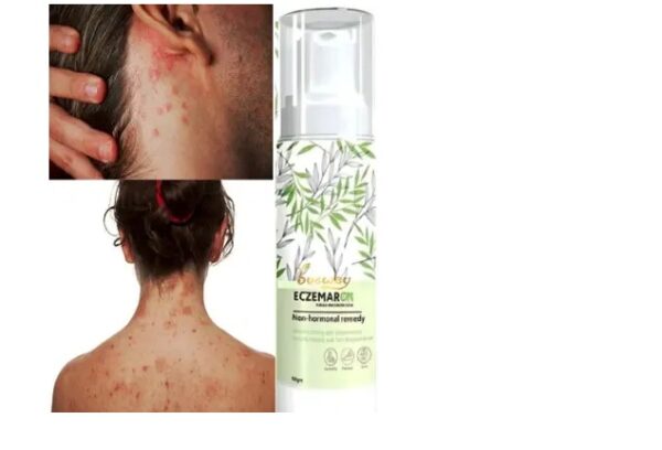 Eczemaron Cream Skin Guard Funga Skin Care SPRAY 50 ml