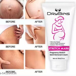 Drybins Stretch Mark Cream For Women For Scars Stretch Mark 60ML