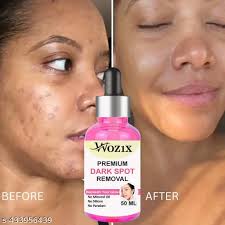 Wozix New Advanced Premium Dark Spots Removal 50 Ml