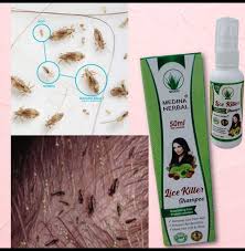 Medina Herbal Lice Killer Shampoo 50Ml