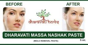 Dharavati massa nashak paste mole removwl paste 5ml